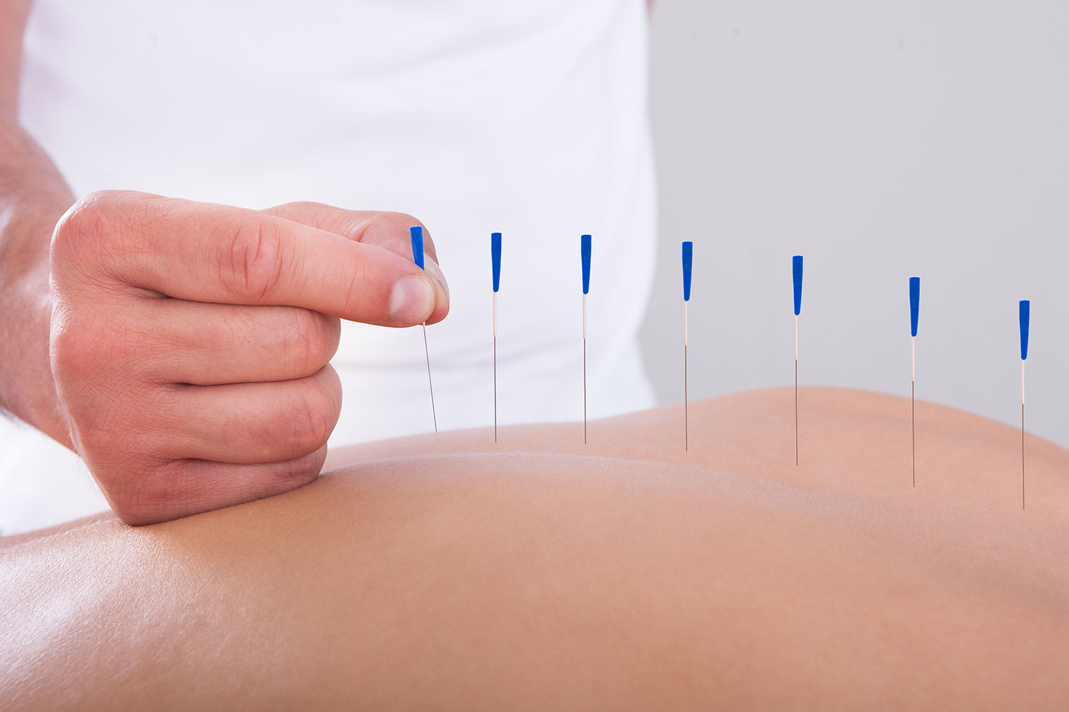 Acupuncture For Weight Loss Part 1